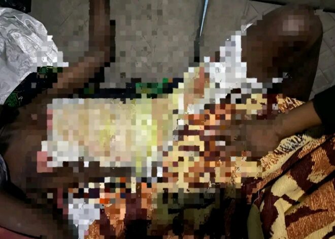 Discussão por 700 Meticais Termina com Homem Queimado em Maputo